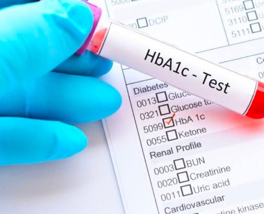 diabetes test Knowing full information about Diabetes