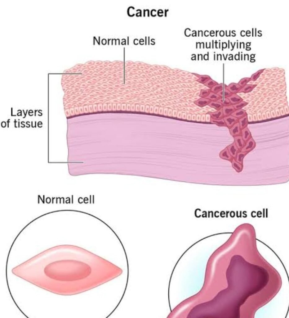 CANCER है बड़ी बीमारी